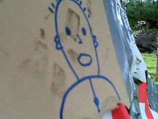 Man gets shot in head by a 22 rifle