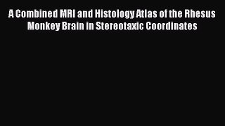 Read A Combined MRI and Histology Atlas of the Rhesus Monkey Brain in Stereotaxic Coordinates