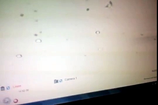 Round and Elangated spermatid Microinjection By Dr. VM Thomas