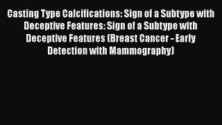 Read Books Casting Type Calcifications: Sign of a Subtype with Deceptive Features: Sign of