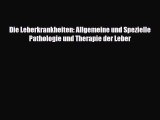 Read Die Leberkrankheiten: Allgemeine und Spezielle Pathologie und Therapie der Leber PDF Online