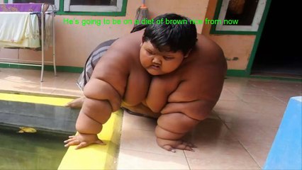Hulk Boy .World’s fattest child, 10, put on crash diet to save his life