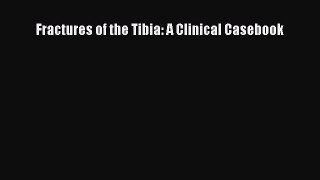 Read Fractures of the Tibia: A Clinical Casebook PDF Online