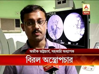 Rare surgery in SSKM hospital