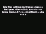 Download Color Atlas and Synopsis of Pigmented Lesions: The Pigmented Lesion Clinic Massachusetts