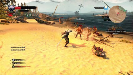 The Witcher 3: Wild Hunt: Gruesome Dismemberment