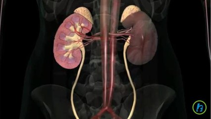 What are Kidney Stones?