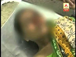 Howrah woman raped victim's byte