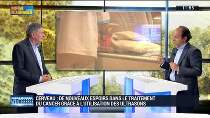 Les ultrasons vont-ils révolutionner les traitements du cancer du cerveau ? - 02/07