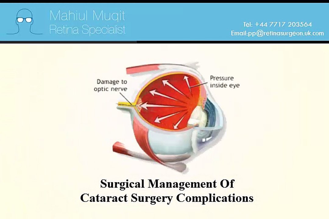 Cataract Surgery By Private Practice of Mr Mahi Muqit PhD FRCOphth