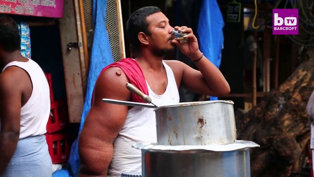 Atteint de gigantisme, le bras droit de cet homme pèse 20 kg