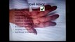 Lecture 2 Mechanisms of Cell Injury  Mod 1