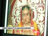 Stop Acid Attacks: After acid attack, a lonely battle for this 22 year old woman Video  NDTV com