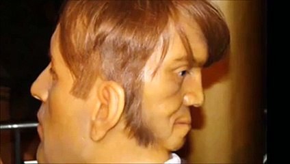 Edward Mordake The man with two faces