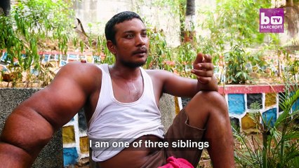 Avec son bras de 20kg cet homme est surnommé le Diable