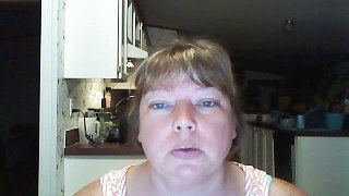 Day 19 Post op Gastric Sleeve Surgery