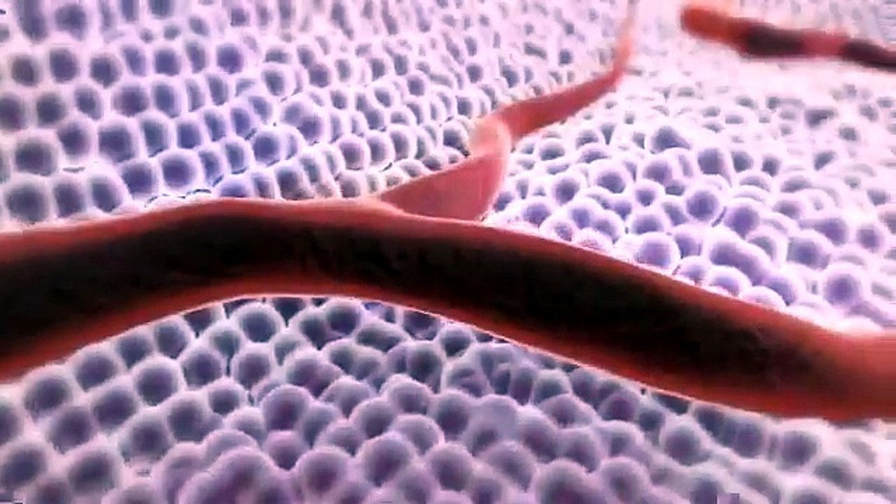 3D Medical Animation   What is Cancer 1