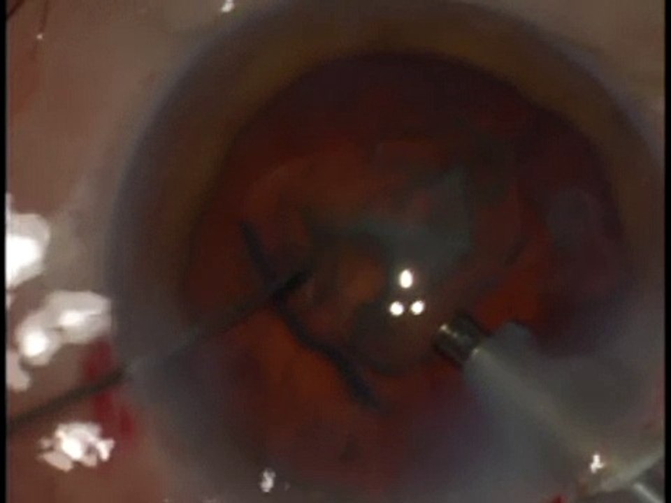 DD faco ultimo fragmento protejo B 30/08/10.wmv