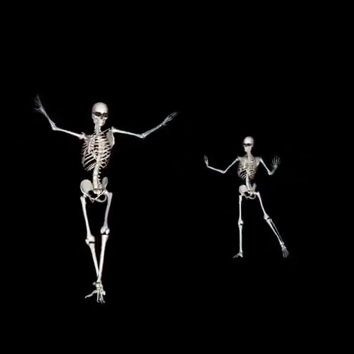 X-ray view of Arab dancing.
