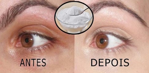 Finish Quickly And Naturally With Dark Circles With Only One Ingredient!