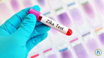 Zika Cases Include 320 Pregnant Women In U.S. According to CDC