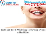 How to use The CORRECT Tooth Whitening Product