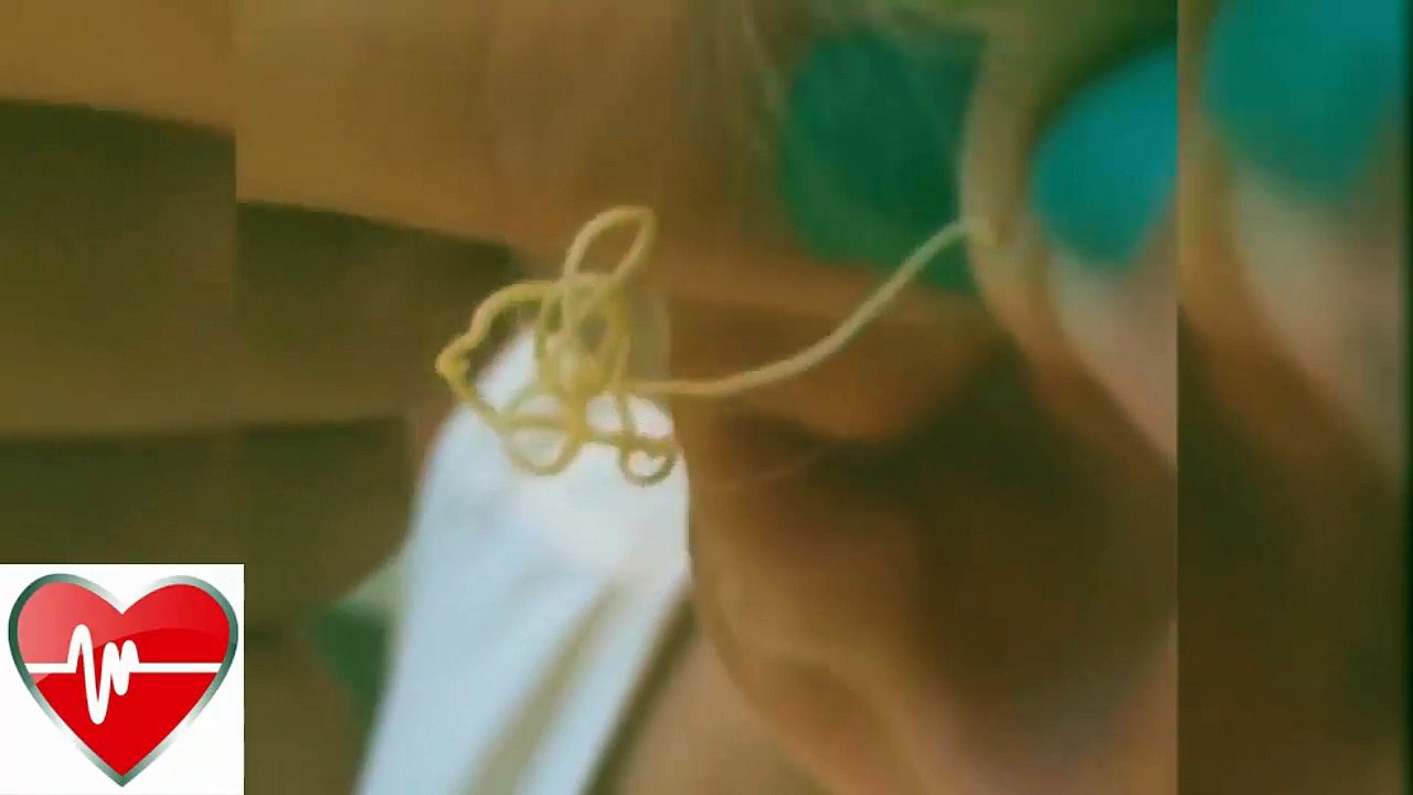 Dr. Pimple. POPPING PIMPLE on ear. All pimples channel