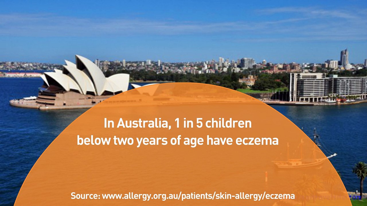 Do You Have Eczema?