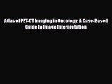 Download Atlas of PET-CT Imaging in Oncology: A Case-Based Guide to Image Interpretation PDF