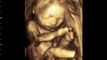 3d/4d Ultrasound AT 23 Weeks from GoldenView Ultrasound