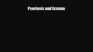 Download Psoriasis and Eczema PDF Online