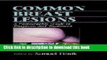 Read Common Breast Lesions: A Photographic Guide to Diagnosis and Treatment Ebook Free