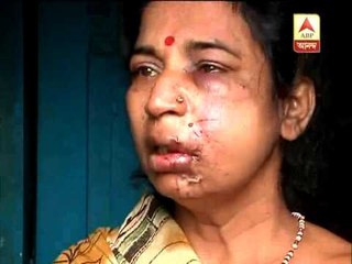 Again snatching happened in the city and the victim is seriously injured