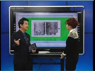 DrTECH22-2-55CapsuleEndoscopy 15 min.mp4