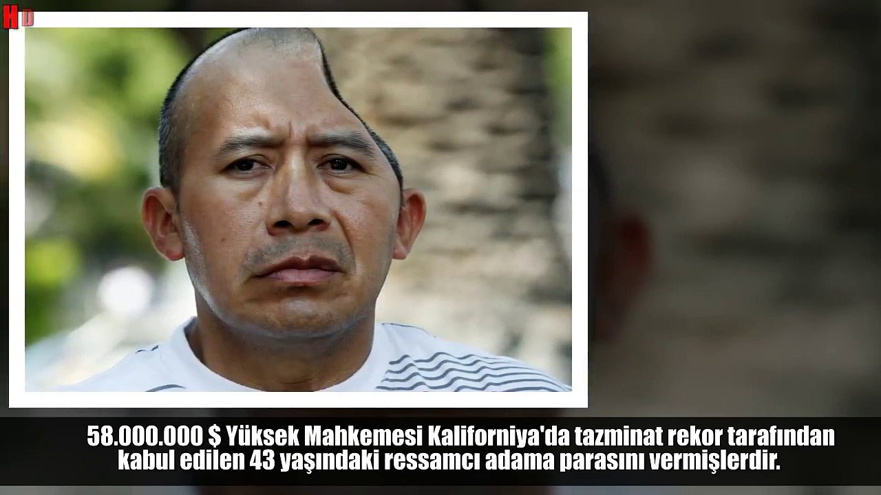 Ölümün Kenarından Dönen 5 İnanılmaz İnsan