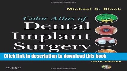 Read Color Atlas of Dental Implant Surgery, 3e  Ebook Free