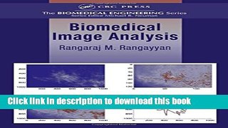 Read Biomedical Image Analysis (Biomedical Engineering)  Ebook Free