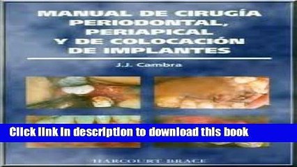 Read Manual De Cirugia Periodontal, Periapical Y De Colocacion De Implantes, 1e (Spanish Edition)