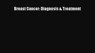 Download Breast Cancer: Diagnosis & Treatment PDF Online