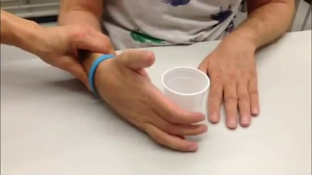 Tratamiento devuelve movimiento parcial a los músculos paralizados