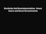 Read Brustkrebs Und Brustrekonstruktion - Breast Cancer and Breast Reconstruction PDF Full