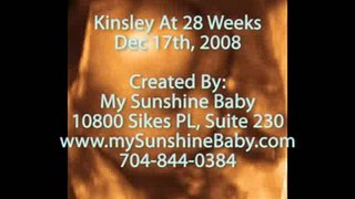 Baby Kinsley 28 weeks 3D 4D Ultrasound Scans - Charlotte 3D/4D Ultrasound
