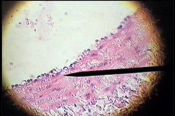Slide 25 - Blood Vessels