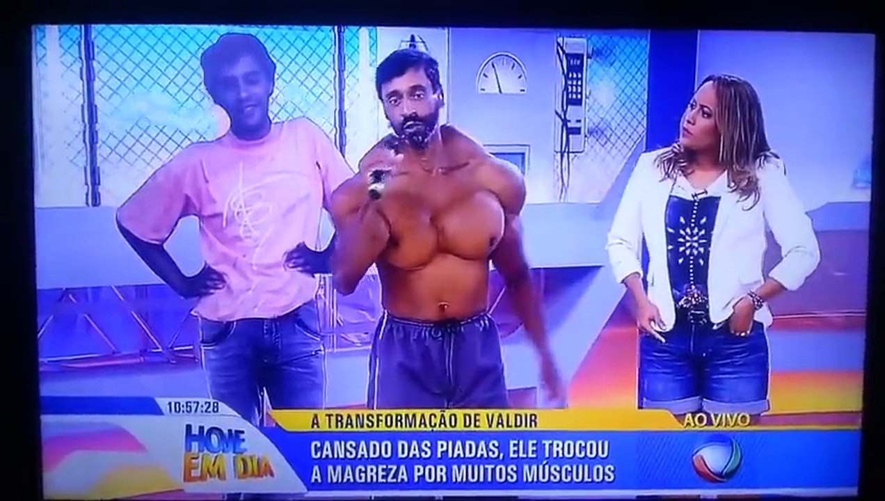 Voilà ce qui arrive quand on abuse des injections de Synthol !