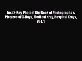 Download Just X-Ray Photos! Big Book of Photographs & Pictures of X-Rays Medical Xray Hospital