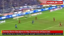 Demba Ba'nın Bacağının X-Ray Görüntüsü Ortaya Çıktı