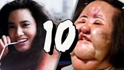 10 operacji plastycznych zakończonych katastrofą [TOPOWA DYCHA]