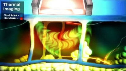 ELOS-эпиляция. Технология, процедура, противопоказания элос эпиляции