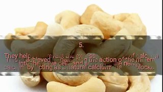 Top 10 Cashew Benefits For Health   Health And Beauty Tips