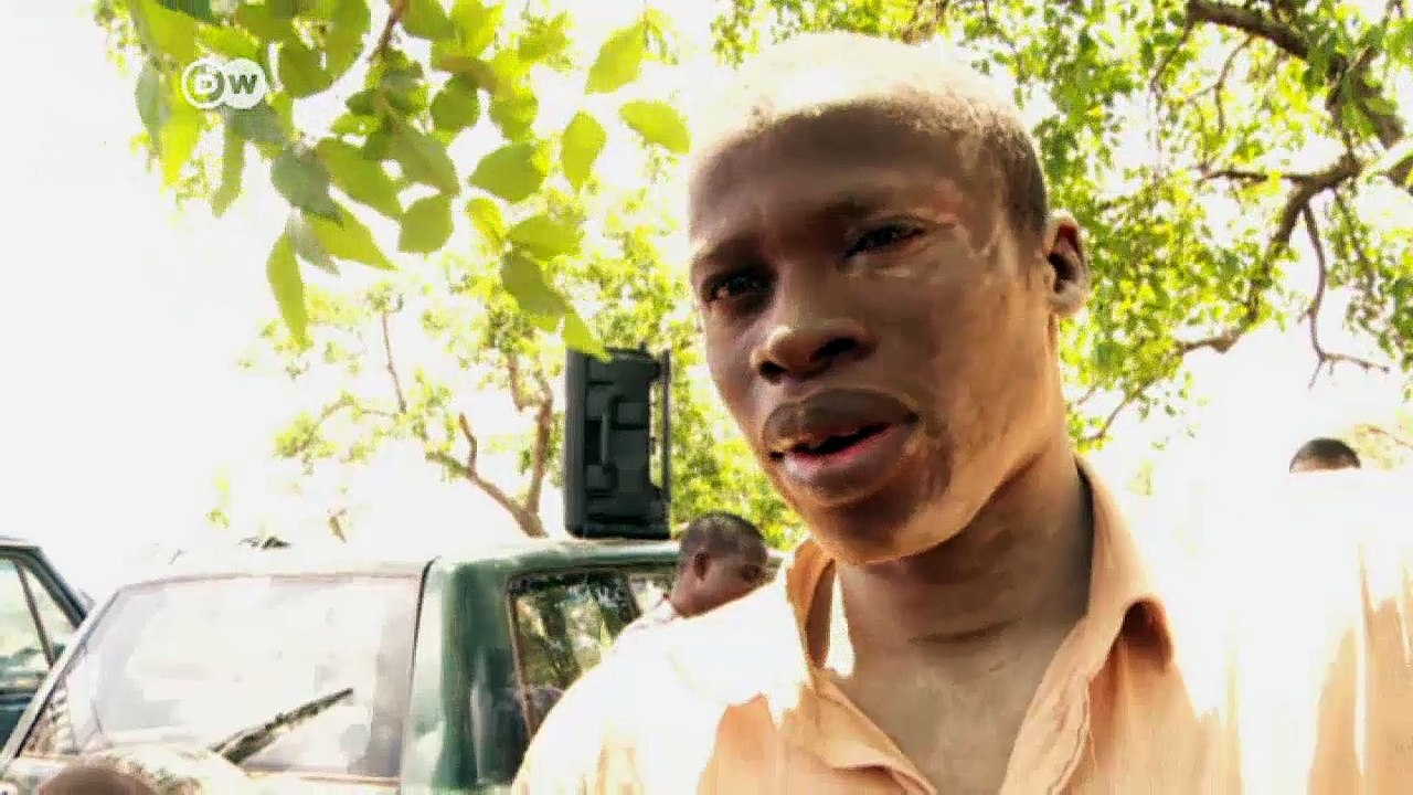 REVS+ - Kampf gegen Aids in Burkina Faso | DW Nachrichten